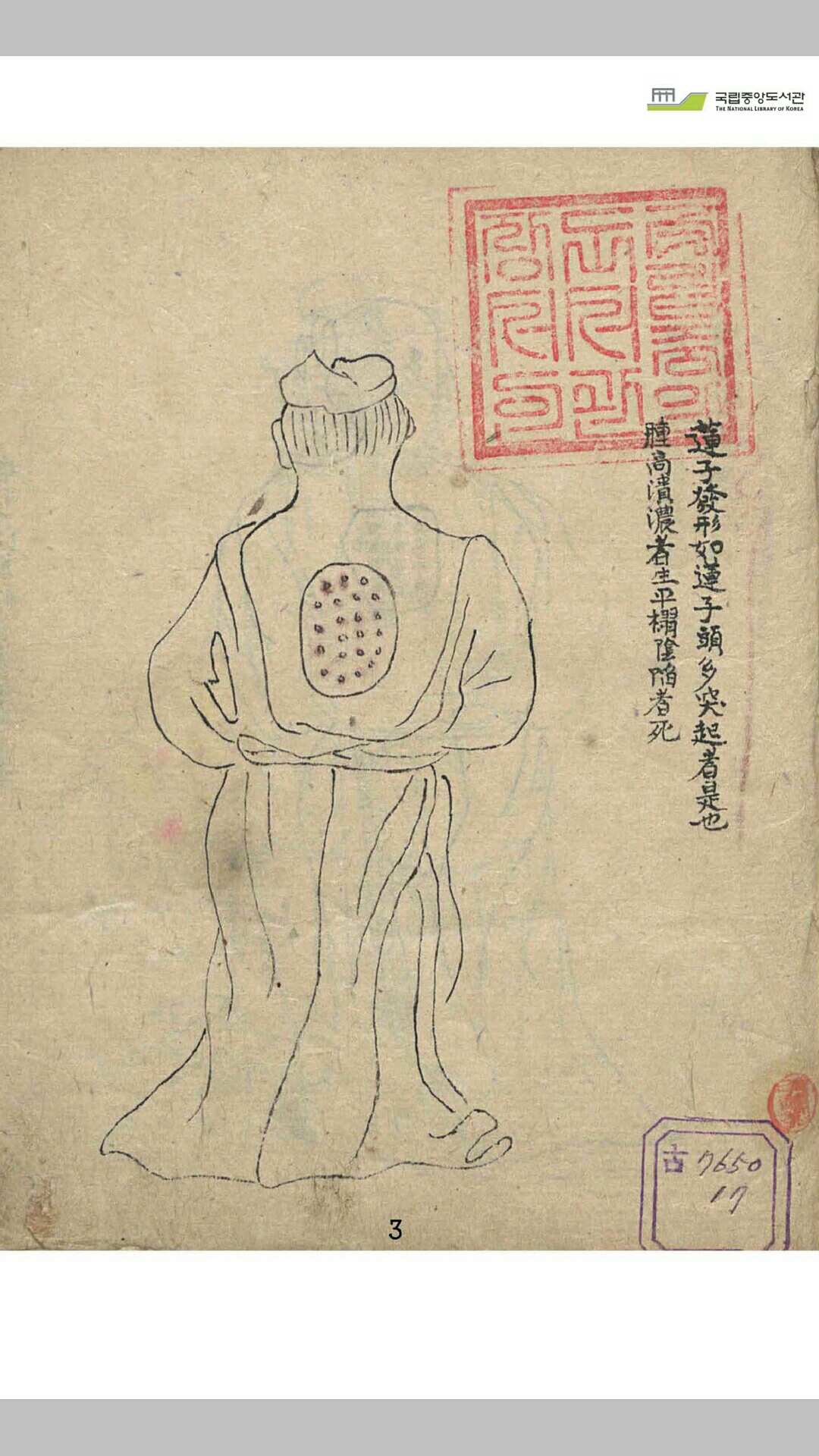肿疮王治方