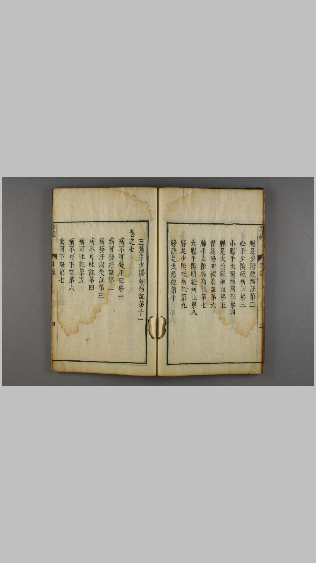 脉经