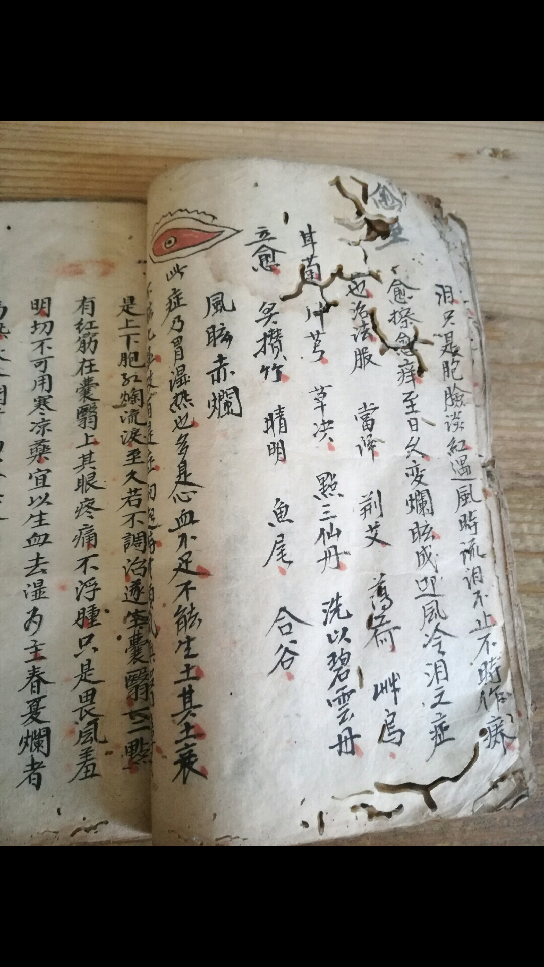 眼