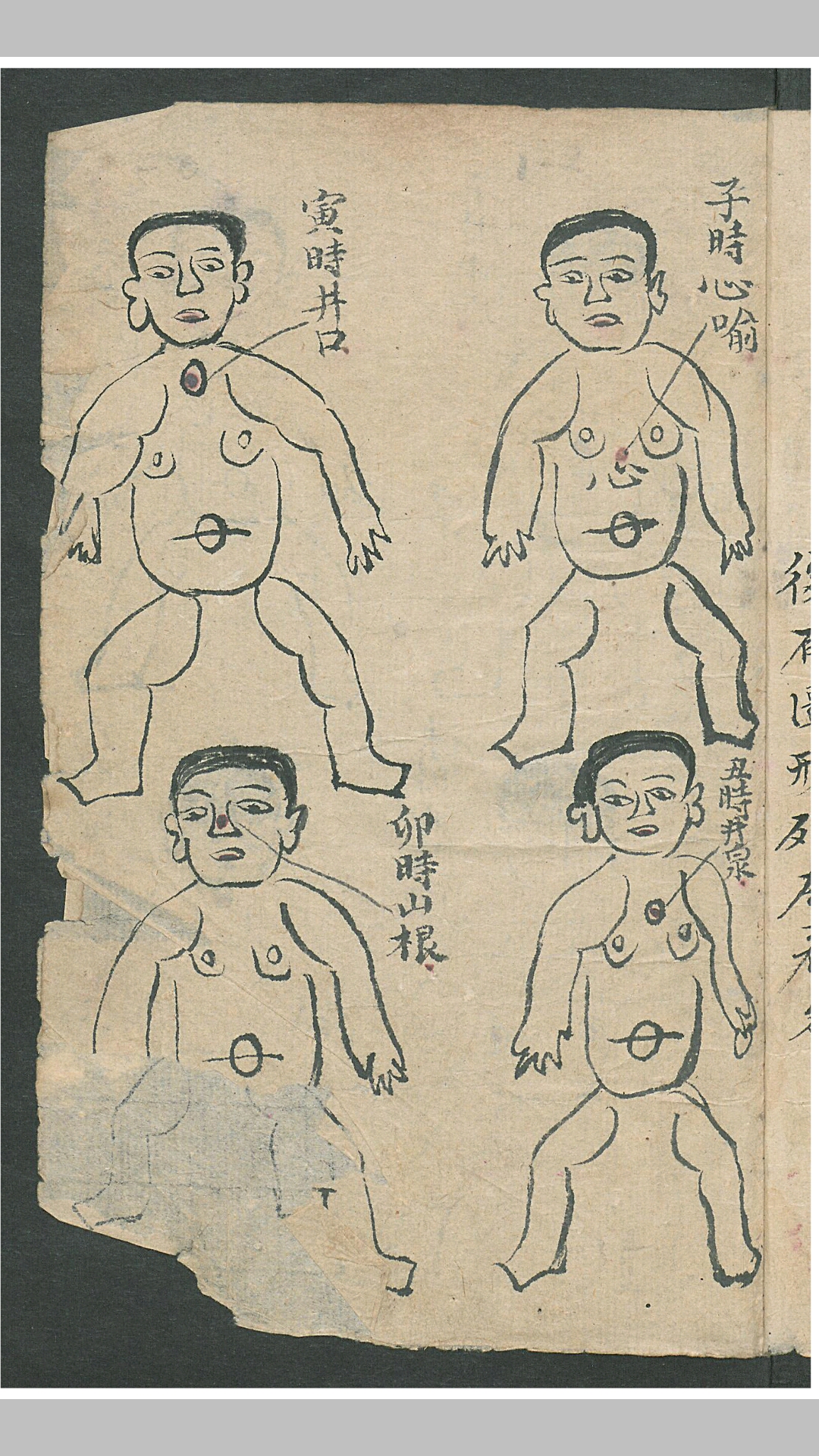 华佗
