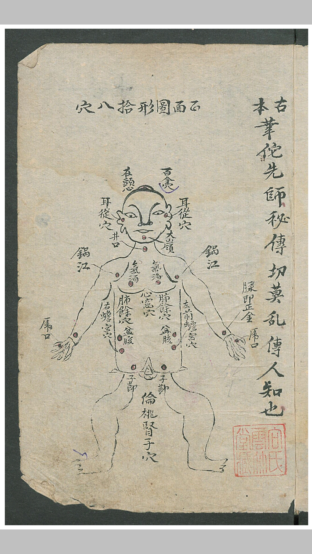 华佗