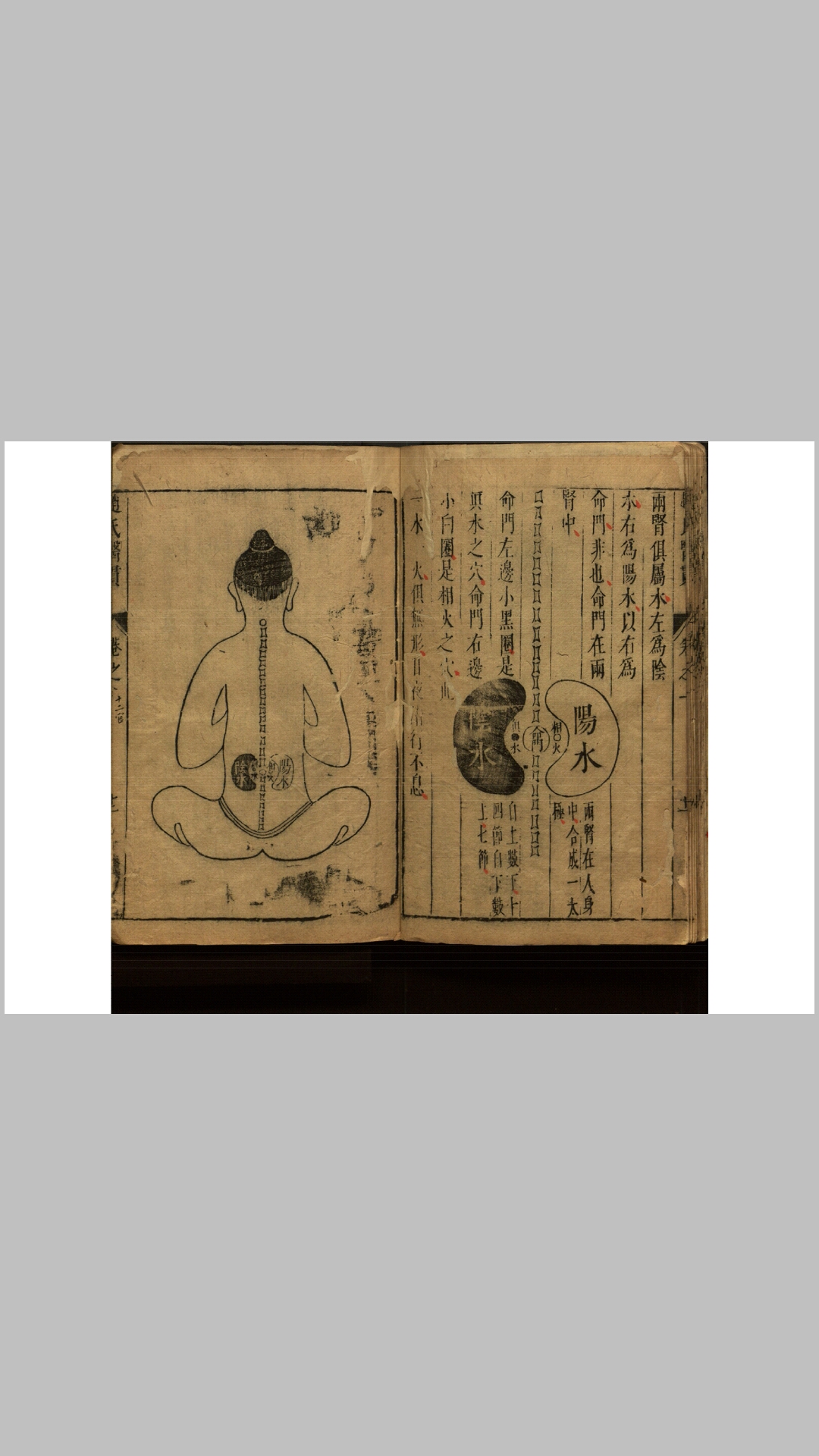 医贯