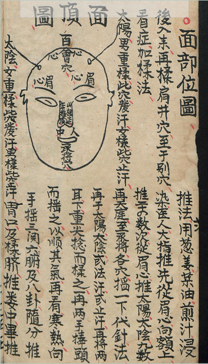 小儿