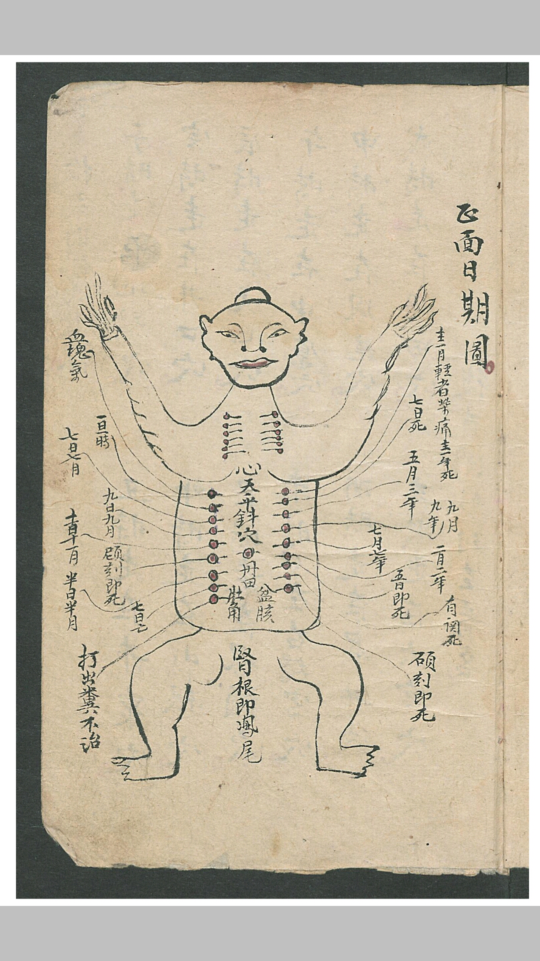 华佗