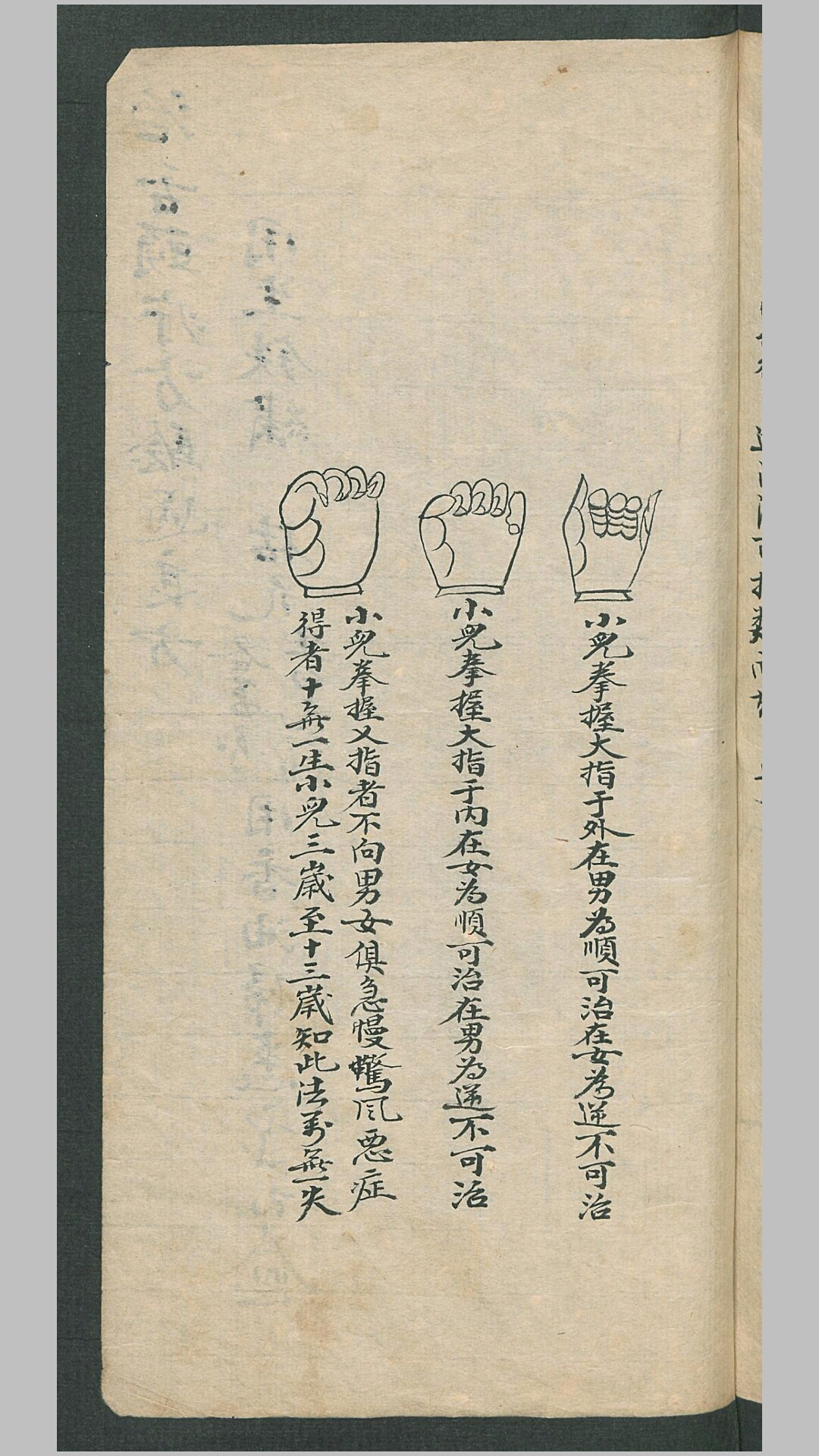 推拿