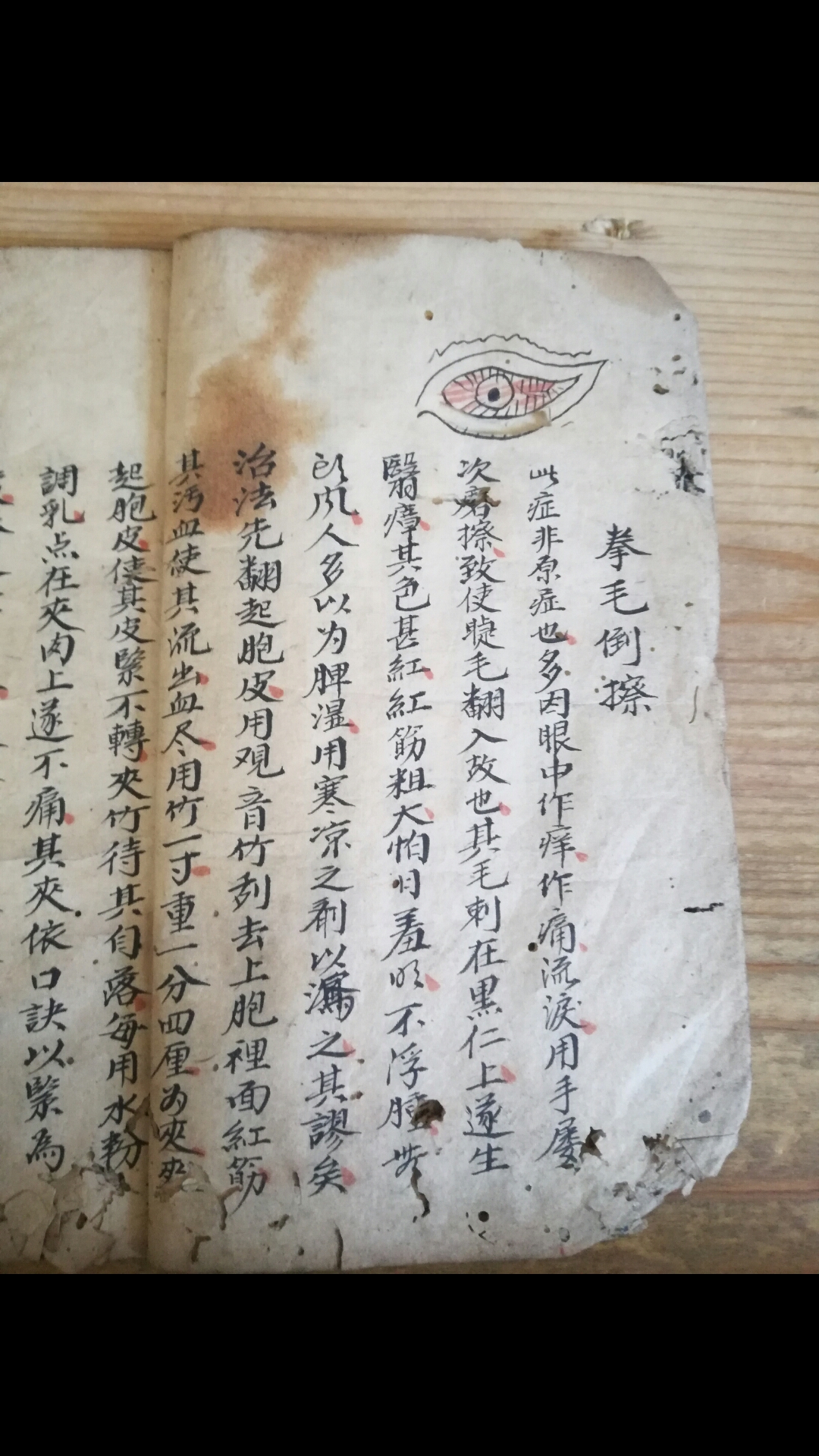 眼