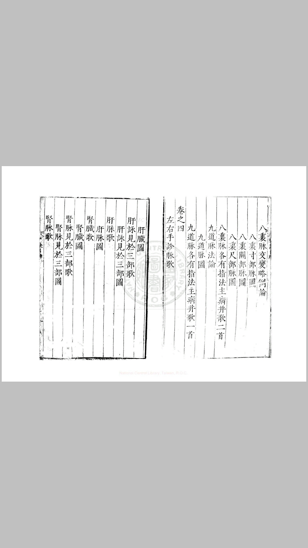 王