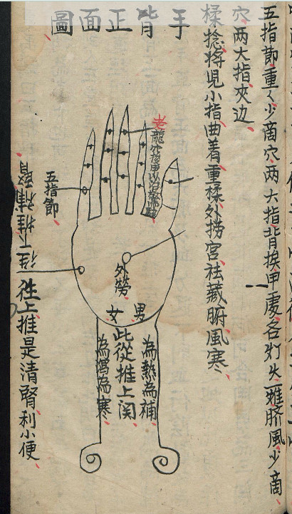 小儿