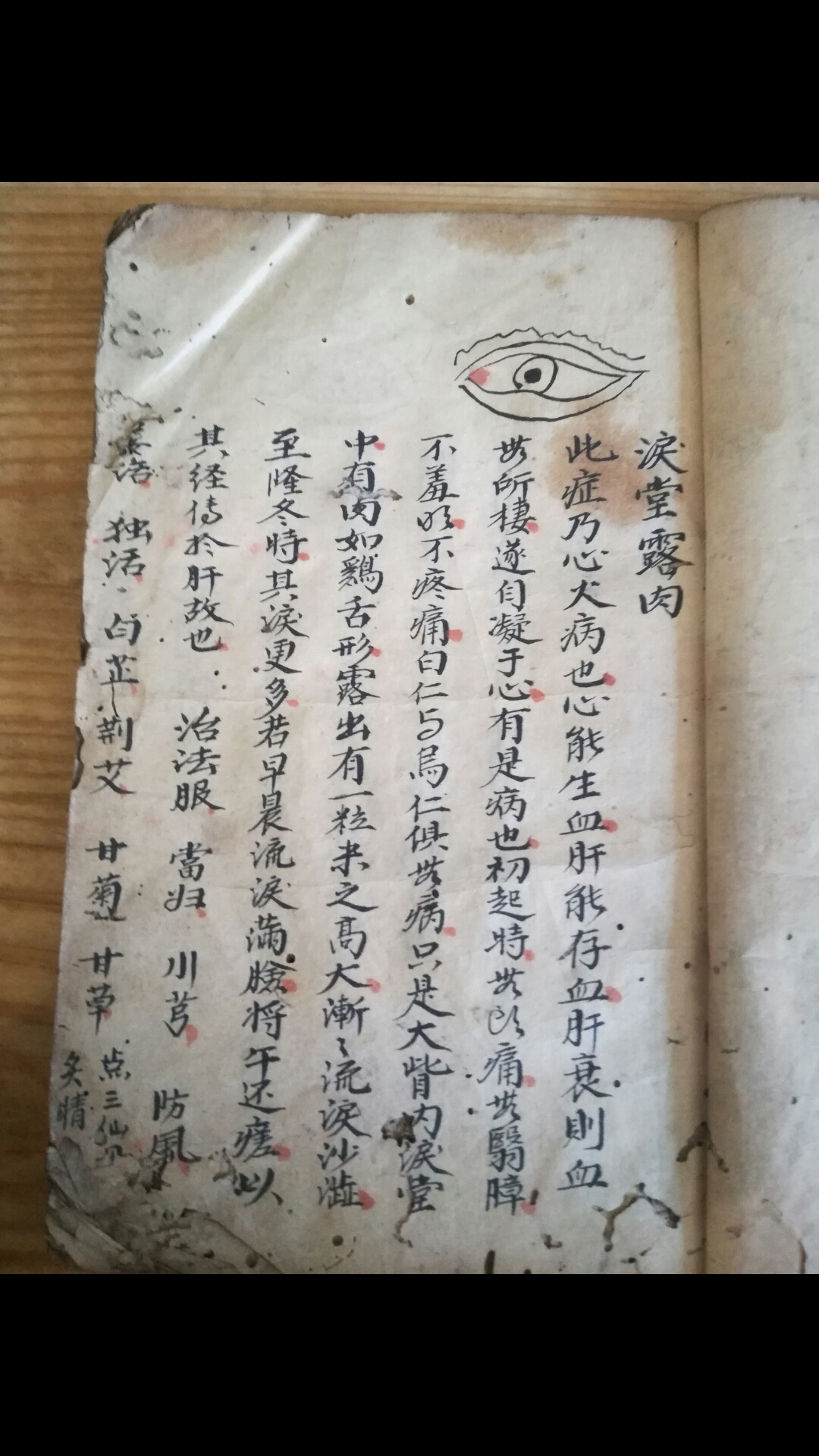 眼